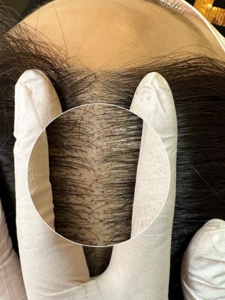 홍대 두피문신 학원,될때까지 잡아주는 곳이 있을까요?1:1 전문 - 두피문신 교육 및 전문가 양성 | 로라도트 SMP 아카데미 홍대 로라도트