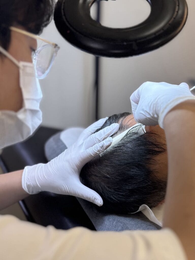 강북 종로 두피문신 학원, SMP 디테일은 가르마부터 시작됩니다! - 두피문신 교육 및 전문가 양성 | 로라도트 SMP 아카데미 강북 종로 두피문신 학원