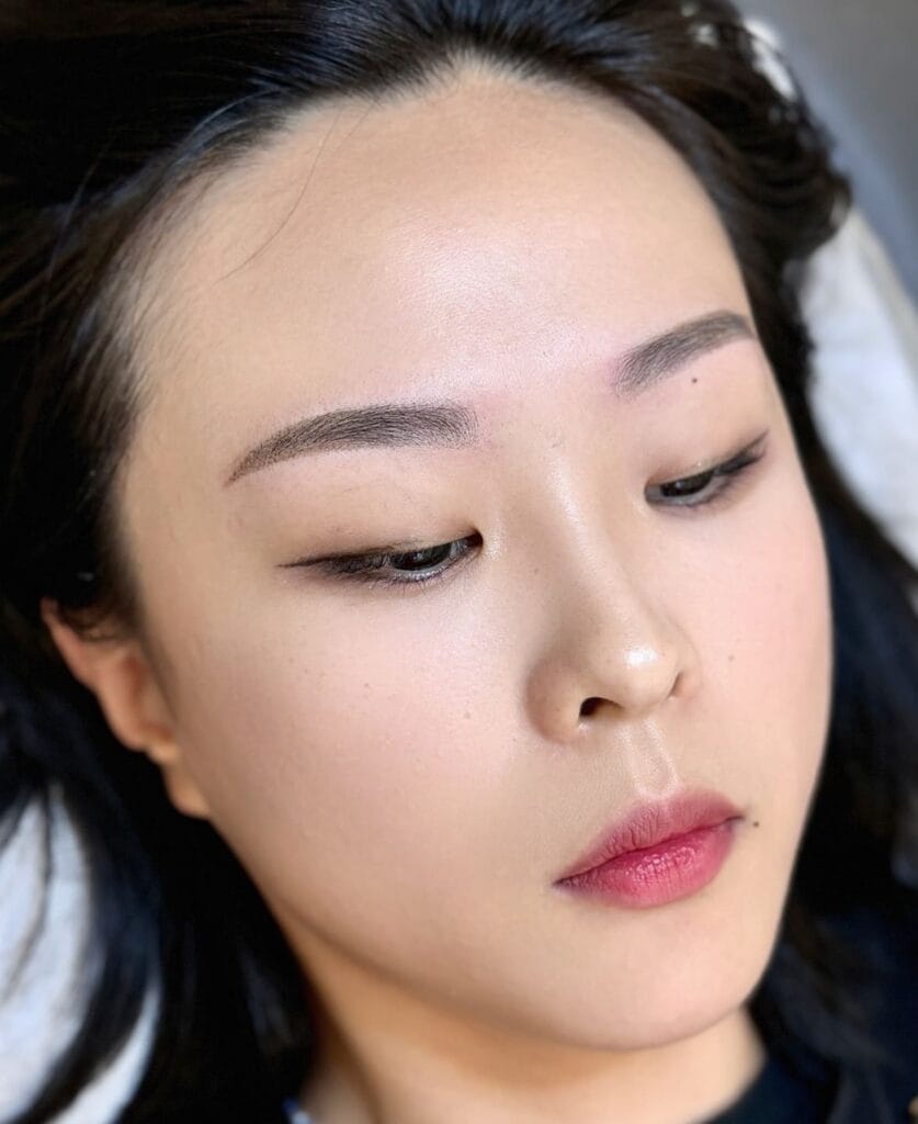 디자인 교정 + 잔흔커버 직후