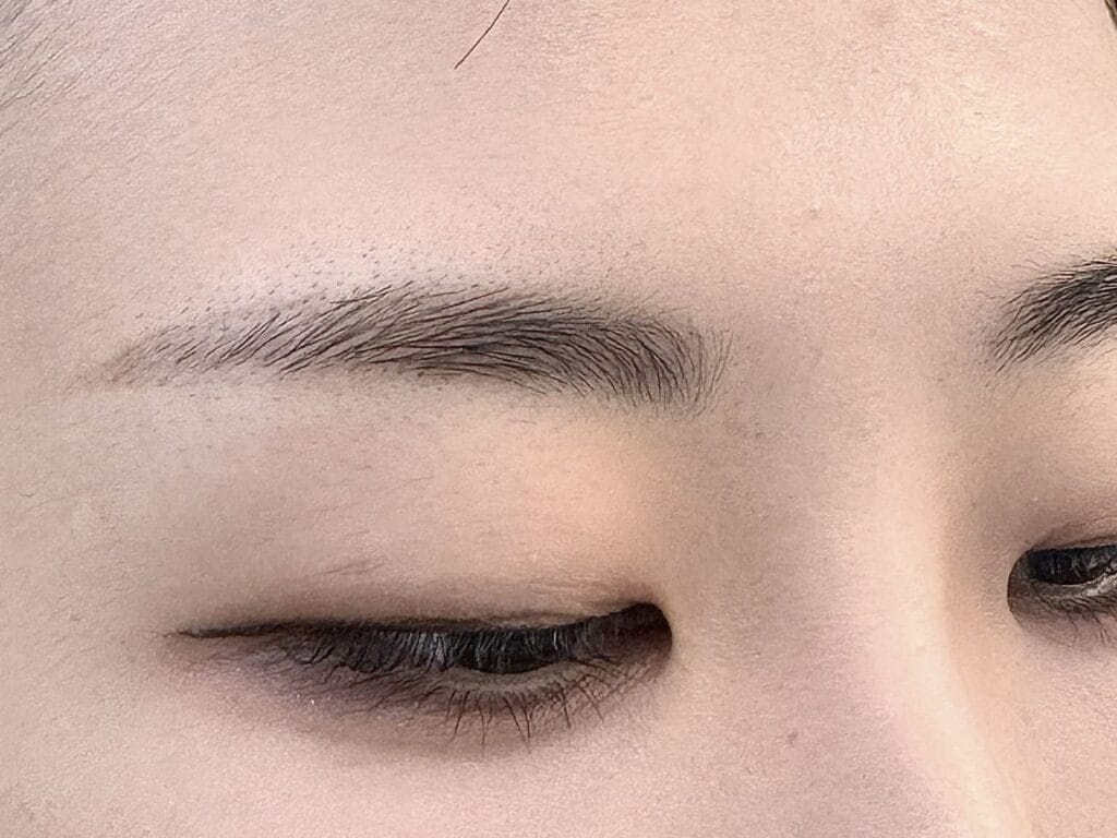 일자로 길게 남은 잔흔