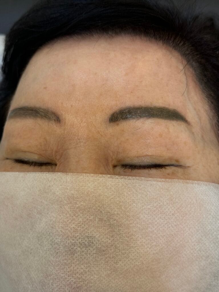 붉은눈썹문신 해결 방법 1가지? / 은평구,성북구,홍대 - 두피문신 교육 및 전문가 양성 | 로라도트 SMP 아카데미 붉은 잔흔 눈썹