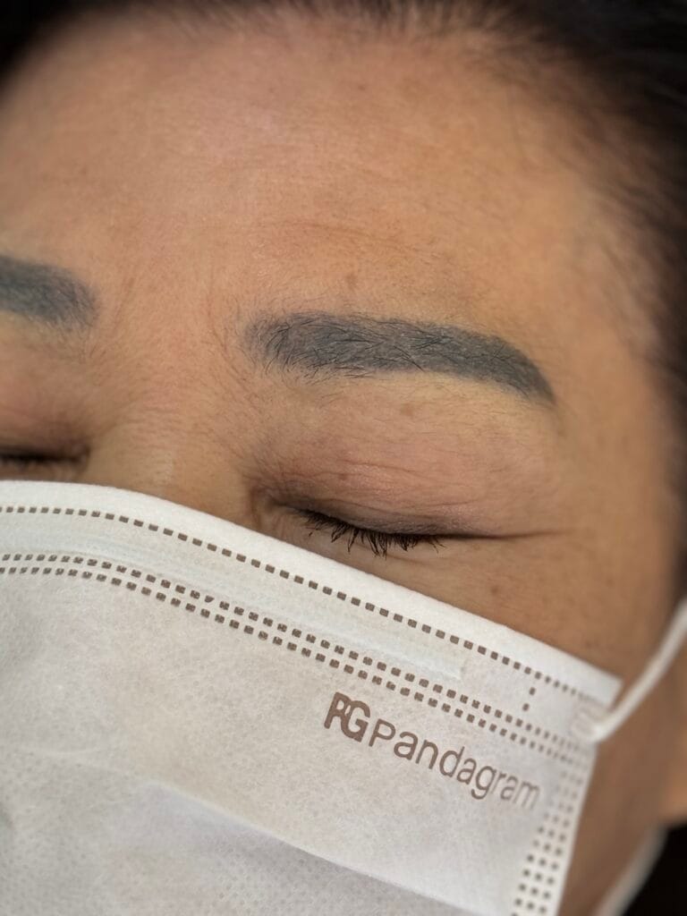 붉은눈썹문신 해결 방법 1가지? / 은평구,성북구,홍대 - 두피문신 교육 및 전문가 양성 | 로라도트 SMP 아카데미 푸른잔흔 눈썹