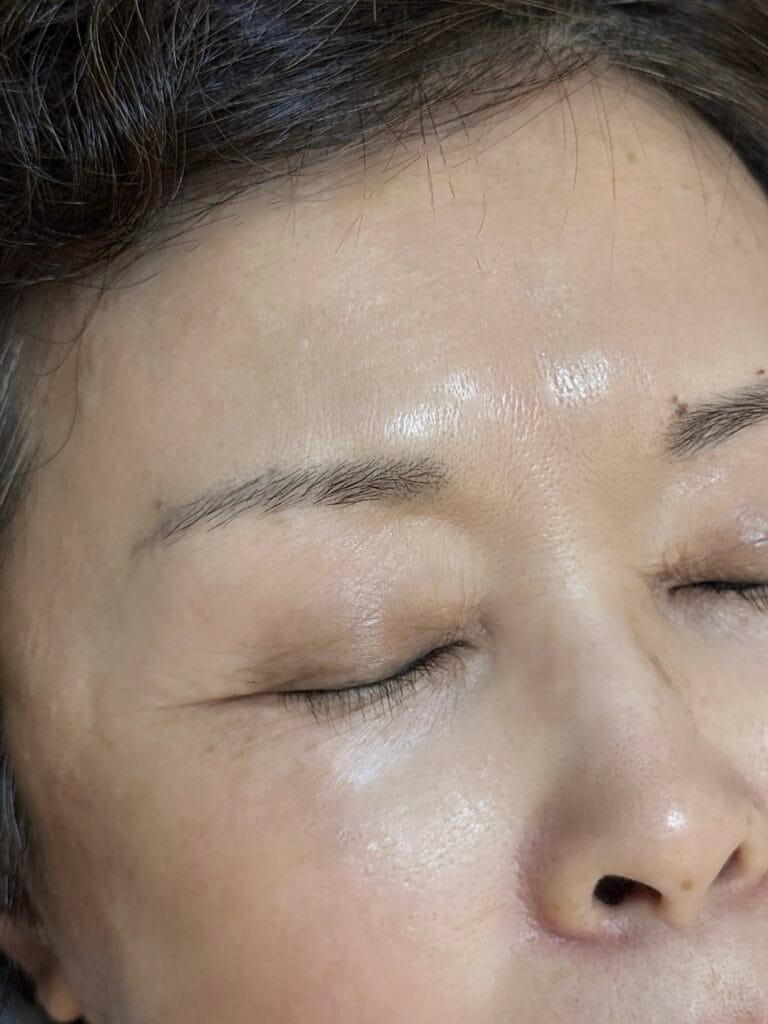 붉은눈썹문신 해결 방법 1가지? / 은평구,성북구,홍대 - 두피문신 교육 및 전문가 양성 | 로라도트 SMP 아카데미 엄마 옛날눈썹