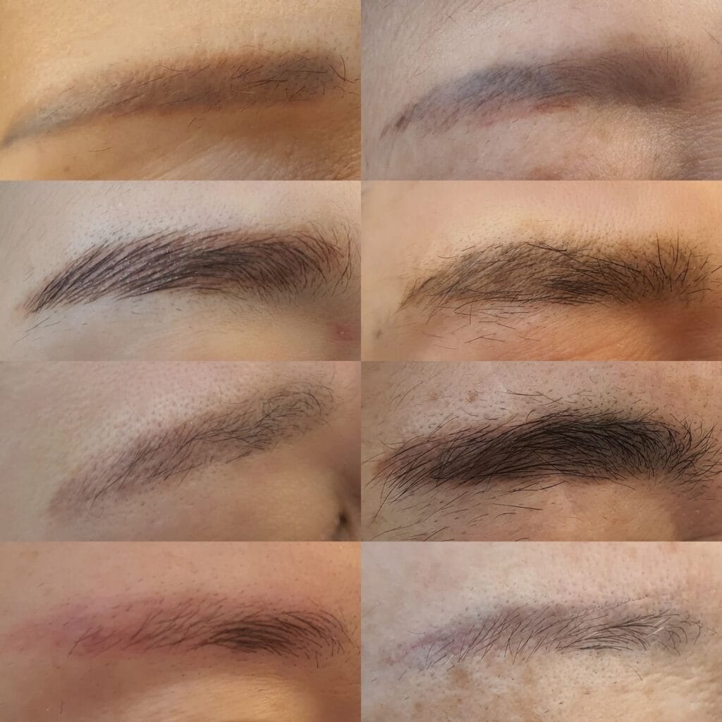 붉은눈썹잔흔, 시간이 지나면 해결될까요? 오히려 더 도드라집니다/은평구,성북구,홍대 - 두피문신 교육 및 전문가 양성 | 로라도트 SMP 아카데미