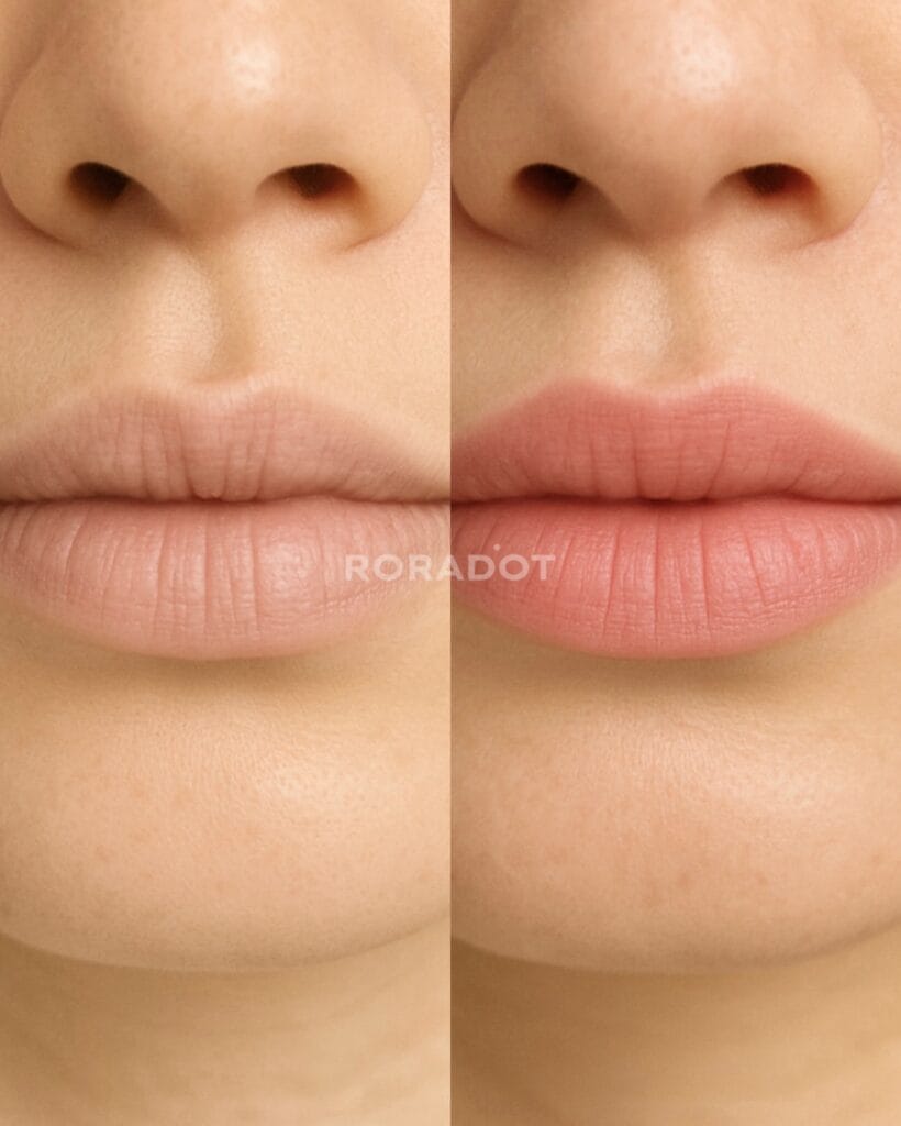 입술문신(입술반영구) 고민 - 두피문신 교육 및 전문가 양성 | 로라도트 SMP 아카데미 입술문신