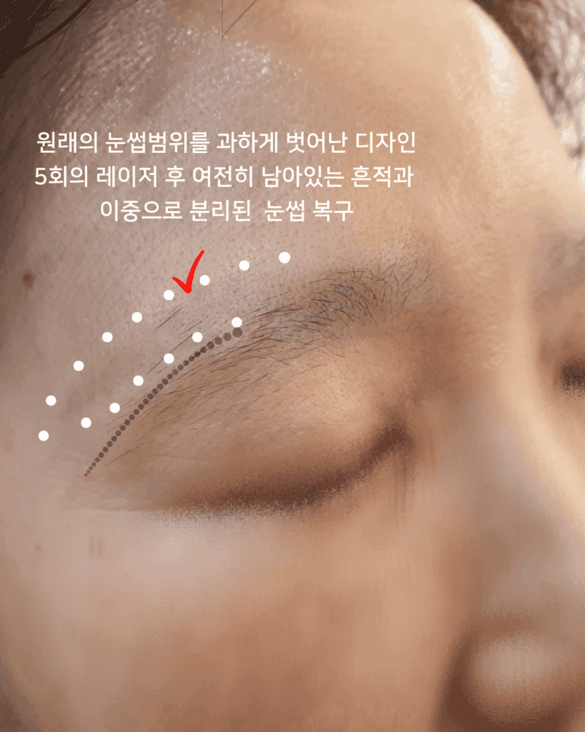 눈썹문신,가격보다 중요한 건 시간이 지나도 자연스러운 결과 - 두피문신 교육 및 전문가 양성 | 로라도트 SMP 아카데미