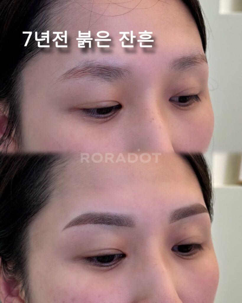 눈썹반영구
