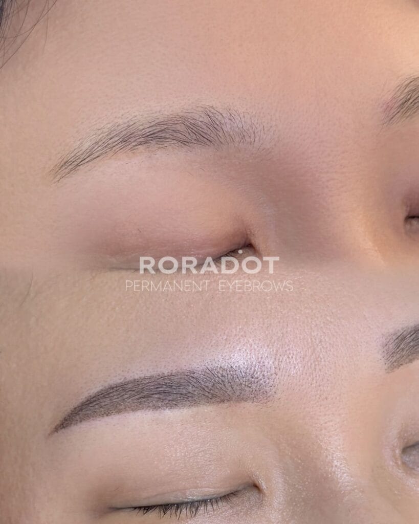 눈썹문신 레이저