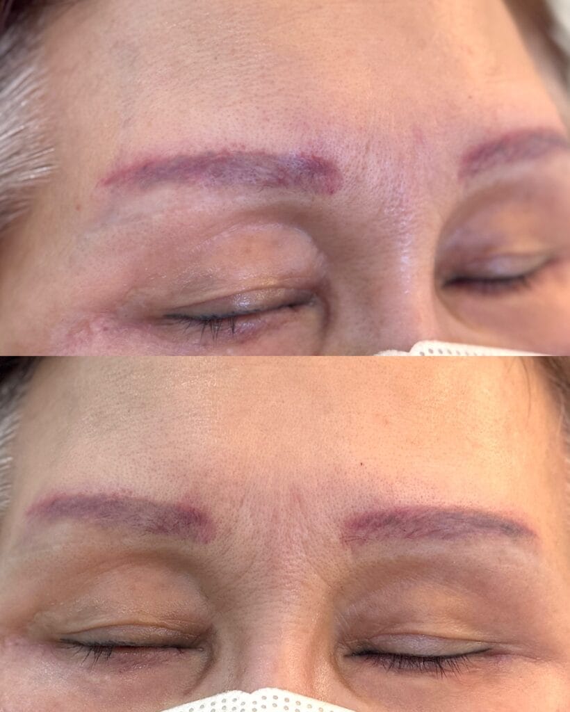 눈썹문신,가격보다 중요한 건 시간이 지나도 자연스러운 결과 - 두피문신 교육 및 전문가 양성 | 로라도트 SMP 아카데미