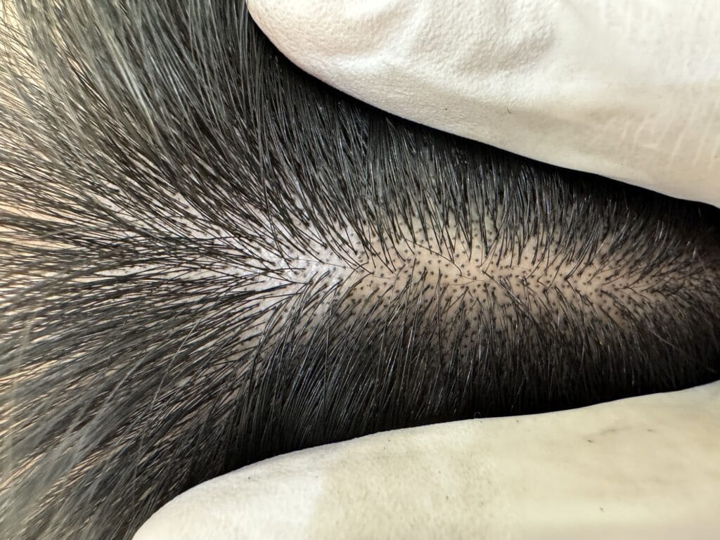 두피문신 교육 NO1, 기술만 배우는 수업으로는 부족합니다. - 두피문신 교육 및 전문가 양성 | 로라도트 SMP 아카데미 두피문신 교육 NO1, 기술만 배우는 수업으로는 부족합니다. - 두피문신 교육 및 전문가 양성 | 로라도트 SMP 아카데미