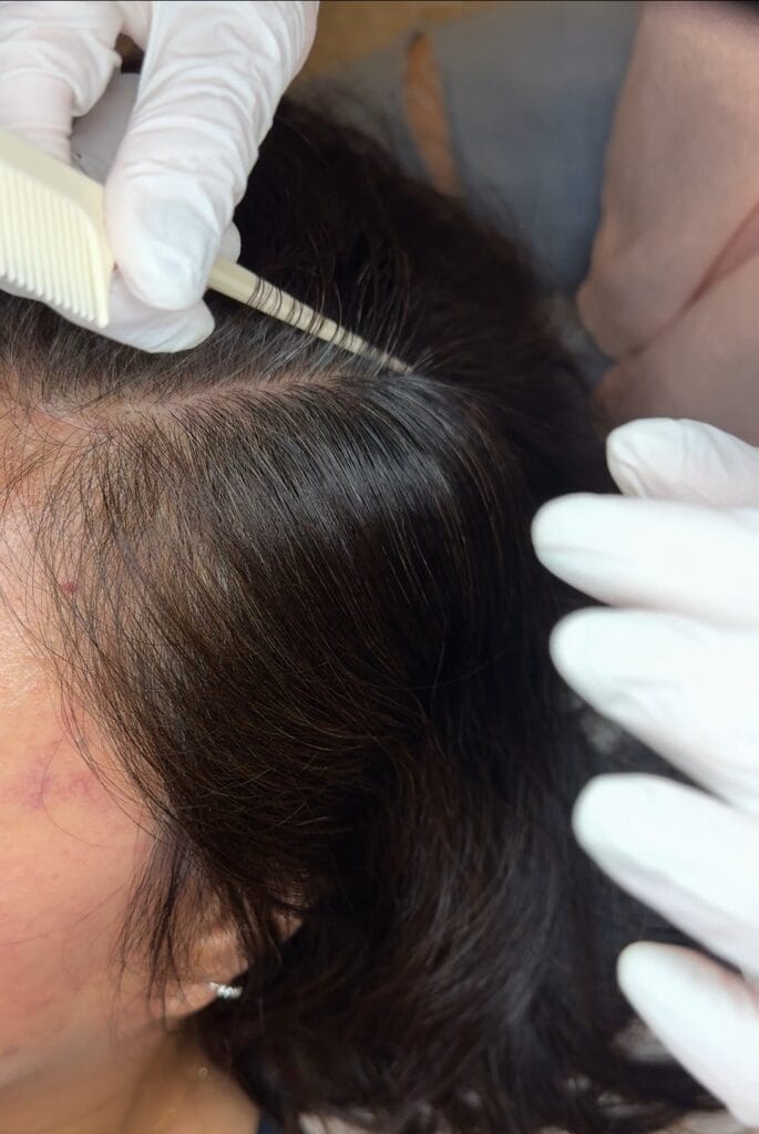 두피문신 교육 NO1, 기술만 배우는 수업으로는 부족합니다. - 두피문신 교육 및 전문가 양성 | 로라도트 SMP 아카데미 두피문신 교육